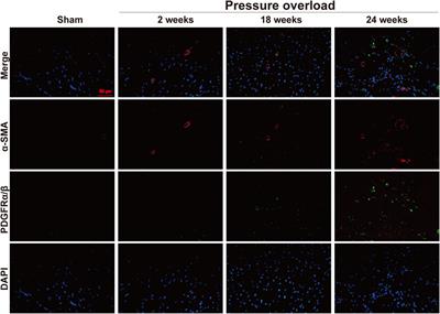 Cardiac sympathetic overdrive, M2 macrophage activation and fibroblast heterogeneity are associated with cardiac remodeling in a chronic pressure overload rat model of HFpEF